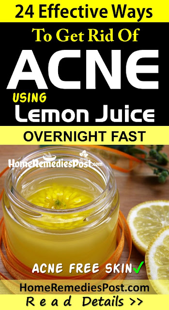 Lemon For Acne, Lemon Acne, Is Lemon Good For Acne, How To Use Lemon For Acne, How To Get Rid Of Acne With Lemon, Lemon And Acne, Lemon For Acne Treatment, Acne Treatment With Lemon, 