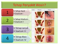 Tanaman Untuk Menyembuhkan Wasir/Ambeien Yang Ampuh Tanaman Untuk Menyembuhkan Wasir/Ambeien Yang Ampuh