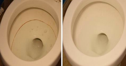 Désinfectez efficacement vos toilettes avec ces deux produits naturels !