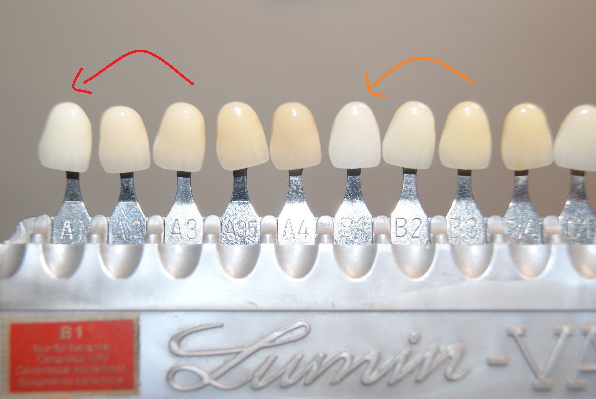 Entenda cor em odontologia e entenda