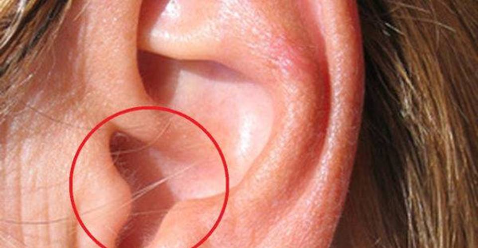 Diy Healthy Hair In The Ears Is The First Sign Of The Most Dangerous