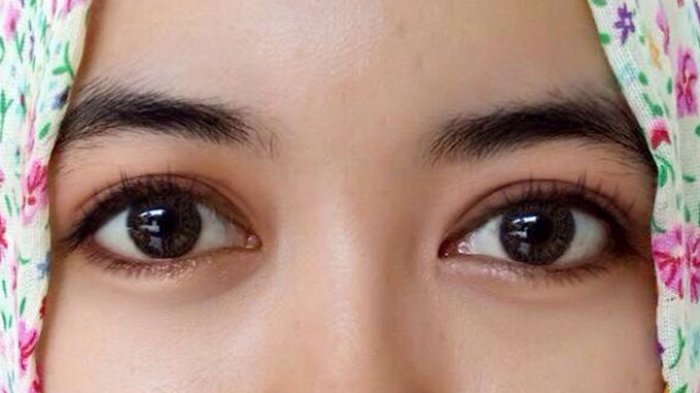 Jadwal Dokter Mata Rs Hermina Bogor Terbaru Jadwal Dokter Rs