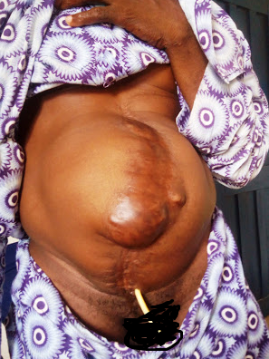 Photos: Man brutally tortured for weeks, thrown down from 3 storey building in PH on alleged order of Navy Commodore, cries for justice