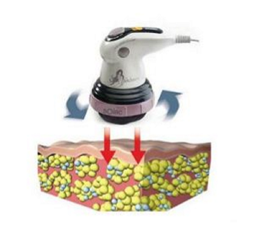 Máquina Lipo Masajeador Anticelulitico Solac Sculptural ME7711