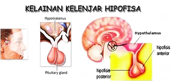 Vruzyid Esterogen dan Progesteron Sel Folikel Ovarium