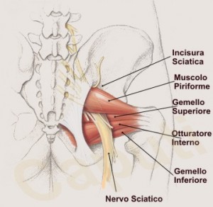 Ciatica la verdadera cura sin mentiras Ciatica la verdadera cura sin mentiras