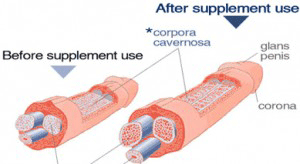 And after before penis enlargement pills Extenze Before