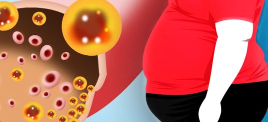 Pengobatan Sembuhkan Kelainan Kolesterol Dislipidemia Secara Alami Pengobatan Sembuhkan Kelainan Kolesterol Dislipidemia Secara Alami