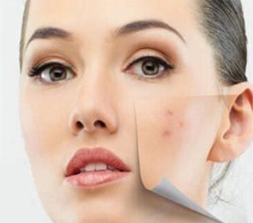 face masks for acne, How to get rid of acne, home remedies for acne, get rid of pimples, remove acne fast, overnight acne treatment, acne removal, acne scars, ways to remove acne, ways to clear acne, remove acne overnight, 