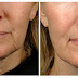 Tight Face Skin Again with Simple Tips