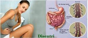 Obat Disentri