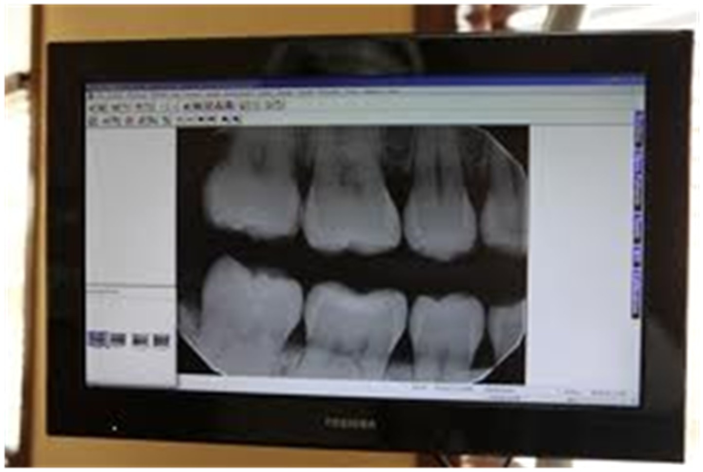 Enlightened Healing Dental Xray Radiation