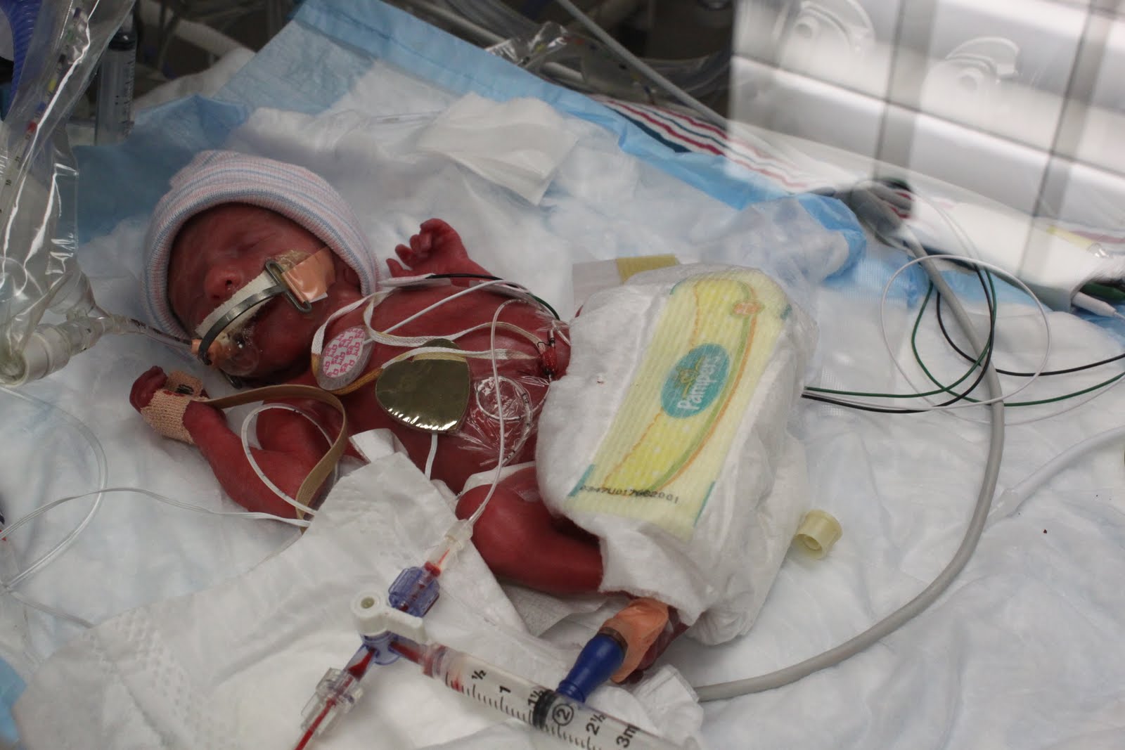 our-story-diaper-change