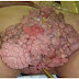 Jual Obat Kutil Kelamin DiKepahiang thumbnail