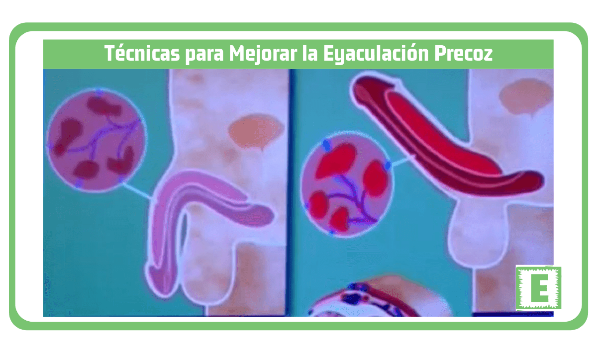 eyaculación precoz simple de