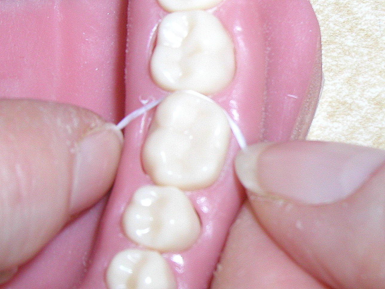 Reynolds Dentistry FLOSSING