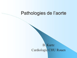 Pathologies de l’aorte