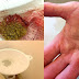 Watch Your Kidney Stones Coming Out With This Amazing Home Remedy