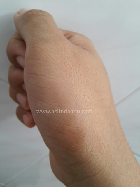 Spray8 Untuk Luka dan Masalah Kulit Spray8 Untuk Luka dan Masalah Kulit