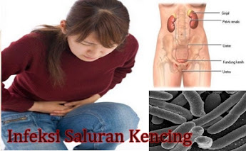 obat infeksi saluran kencing karena bakteri obat infeksi saluran kencing karena bakteri