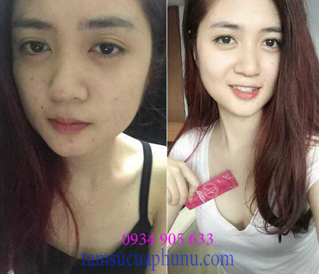 Có nên sử dụng thuốc tăng kích thước vòng 1 ipink không? Có nên sử dụng thuốc tăng kích thước vòng 1 ipink không?
