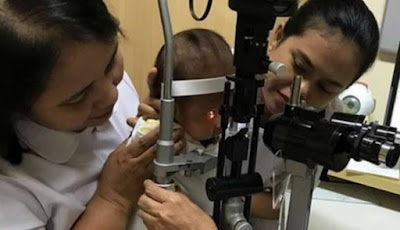 Cara Mengobati Mata Katarak Pada Bayi Cara Mengobati Mata Katarak Pada Bayi