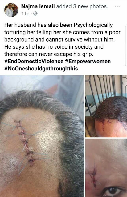  "This is the man who has sworn to kill my younger sister" - Kenyan man calls out brother-in-law over physical abuse of his sister