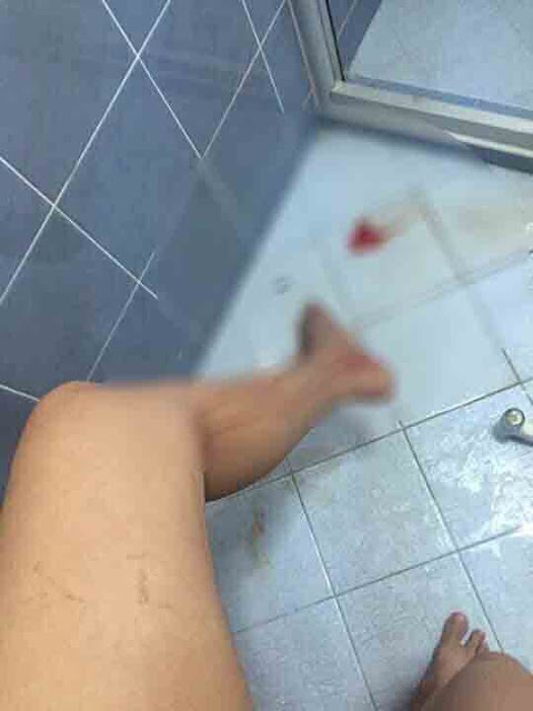 Man Was Bitten By A Huge Snake That Came Out Of His Toilet, What He Did Next Was Shocking! Man Was Bitten By A Huge Snake That Came Out Of His Toilet, What He Did Next Was Shocking!