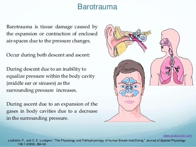 Баротравма это простыми словами в медицине. Баротравма легких.
