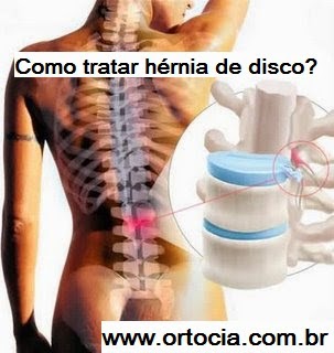 hernia de disco