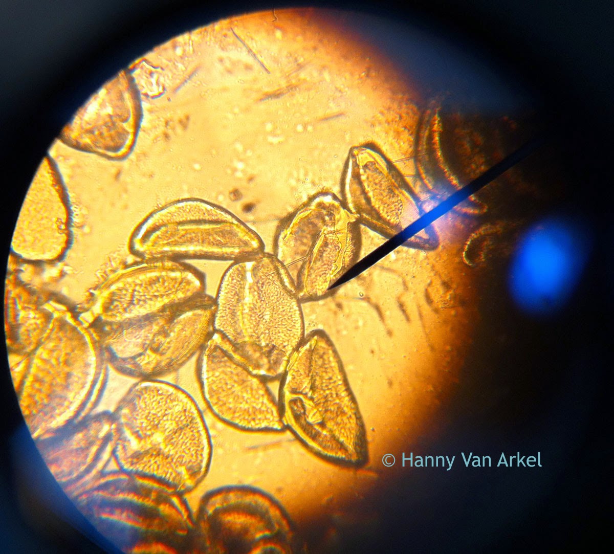 Pollen microscopy image at 400x