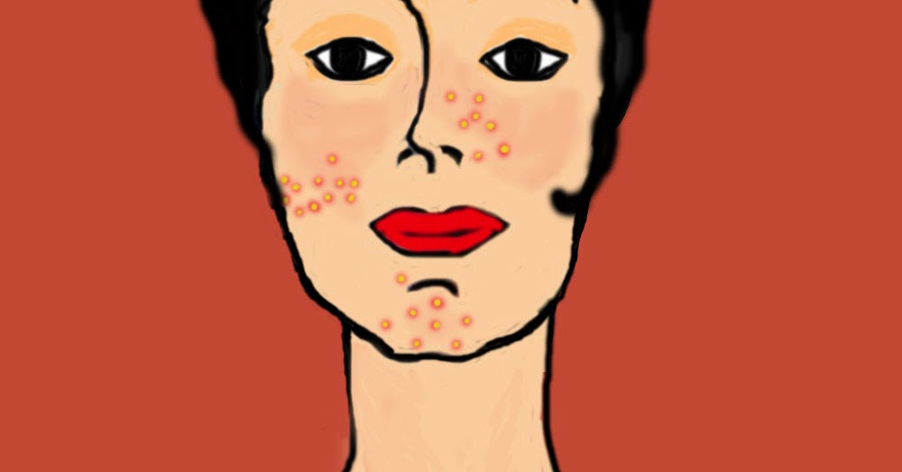 Crema per comedoni di faccia il prezzo