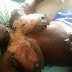 Man Baths His Wife With Hot Oil In Nasarawa State - Graphic Photos