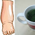 This Tea Is The Best Remedy For Swollen Legs 
