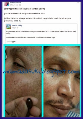 Testimoni vitamin E Shaklee untuk kulit