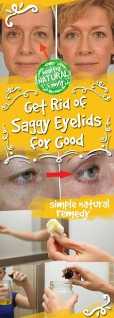 This Simple Remedy Will Help You Get Rid of Saggy Eyelids for Good