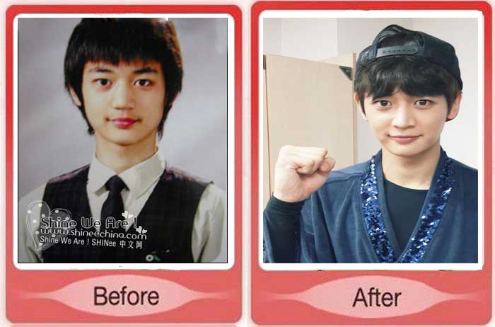 Lee Min Ho Plastic Surgery- Did Lee Min Ho Get Plastic Surgery? | Kpop