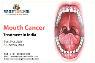 Mouth Cancer Treatment in India