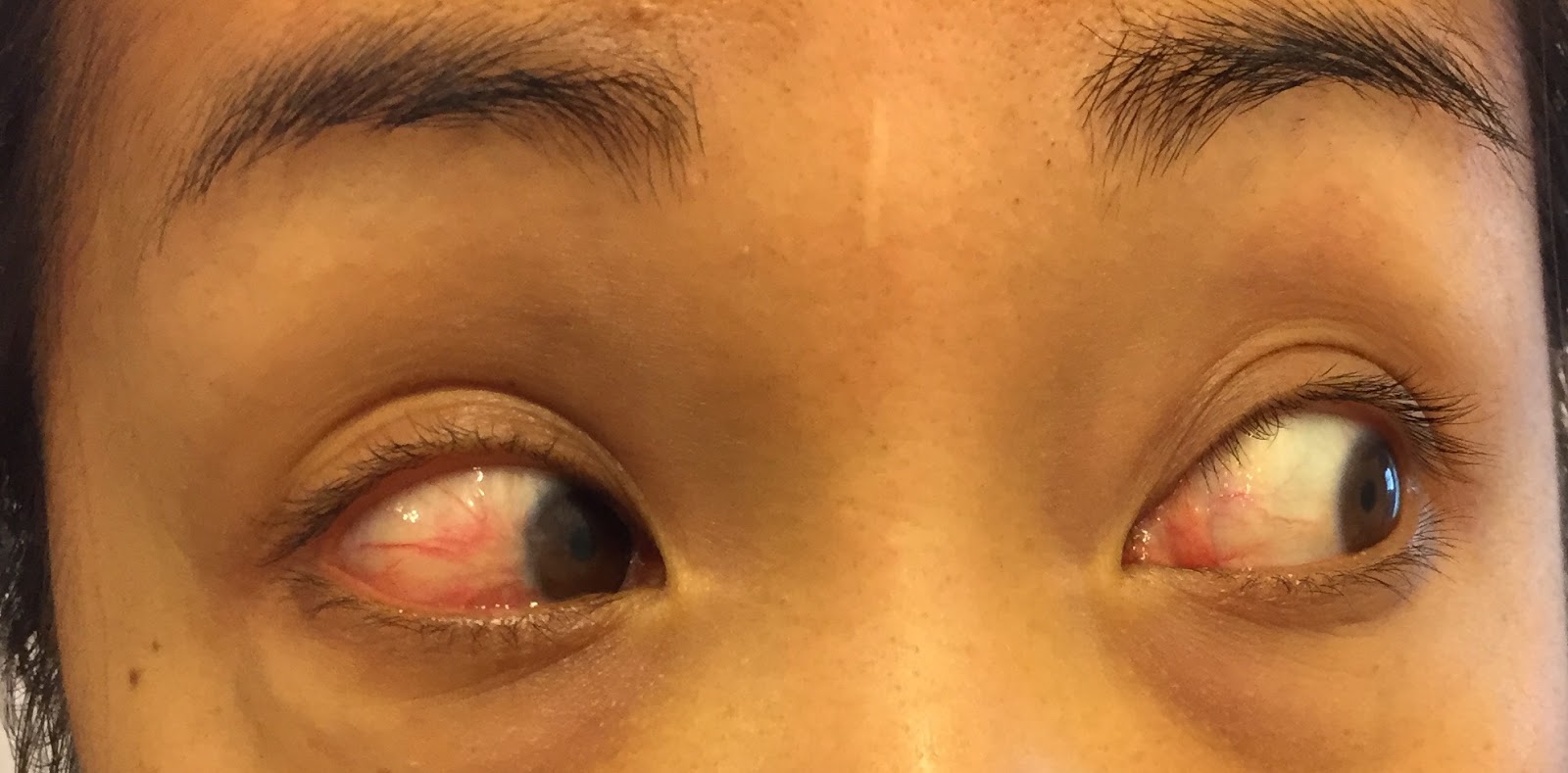 My eye Eyes the least red it will be (first waking up in the morning)