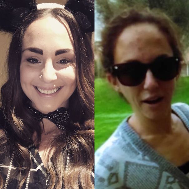 10+ Before-And-After Pics Show What Happens When You Stop Drinking - 1 Year Difference