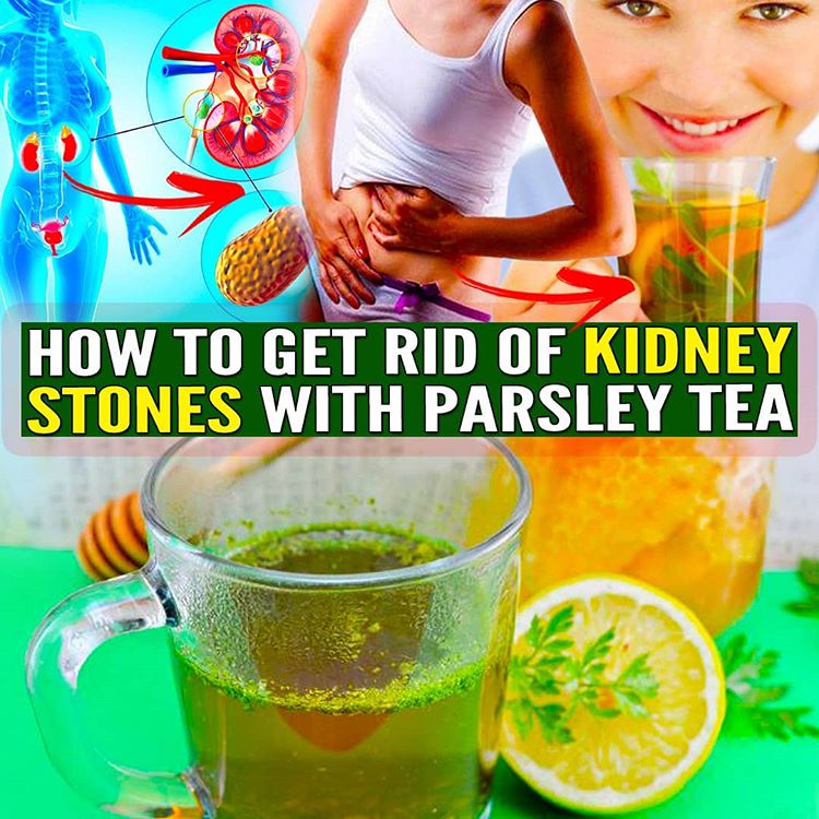 How To Get Rid Kidney Stones With Parsley Tea Wellness Food Team