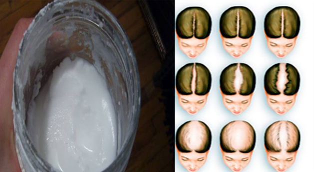 La vitamina aevit para los cabellos de la máscara para el crecimiento de los cabello