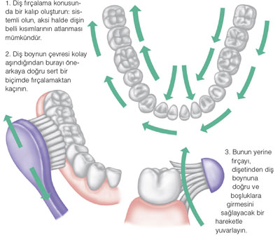 Implant Hangi Bolume Girer Uzm Dt Ela Cabuk