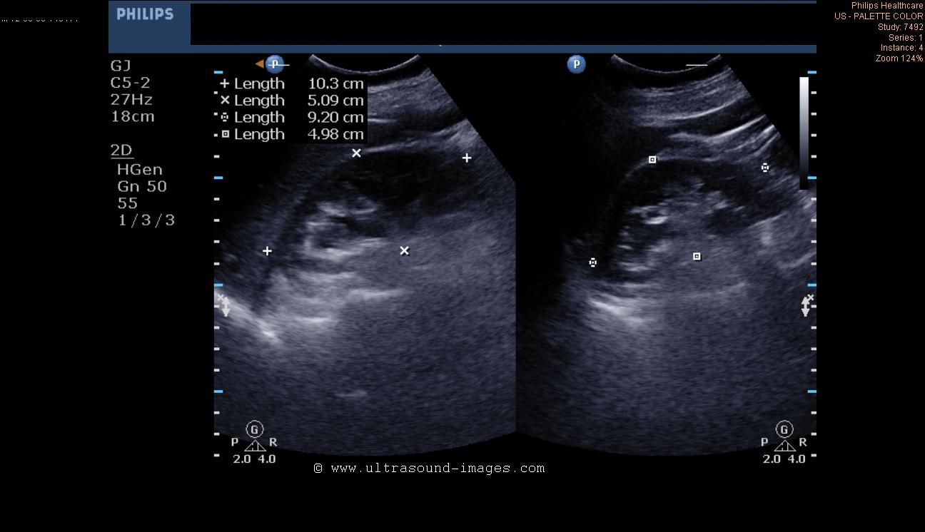 Ultrasound imaging june 2012