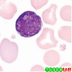 Nguyên bào lympho