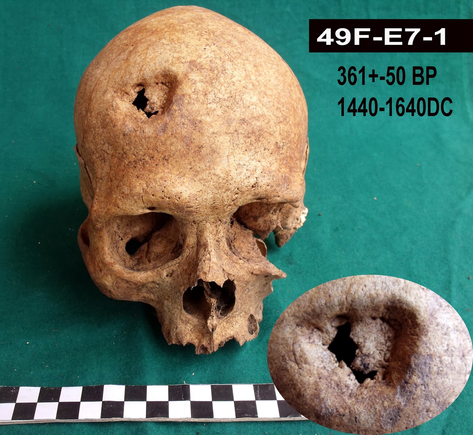 Bioarchaeology of Ancash Skull Trepanations