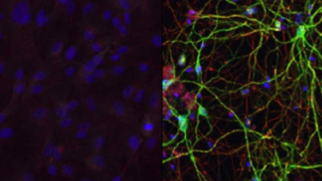 علماء يتمكنون من تحويل خلايا الجلد مباشرةً لخلايا مخ