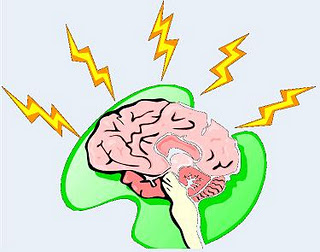 Paxil Withdrawal Symptoms Brain Zaps
