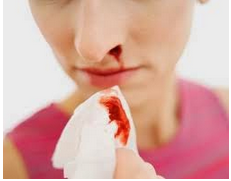 Image result for Symptoms and Signs of Leukemia