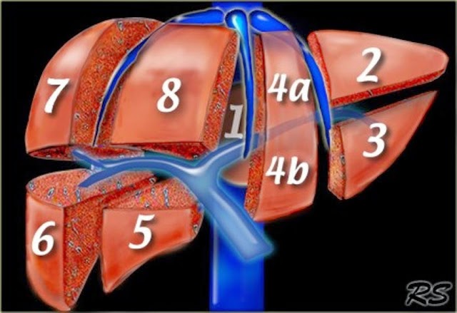 Segmentación hepática